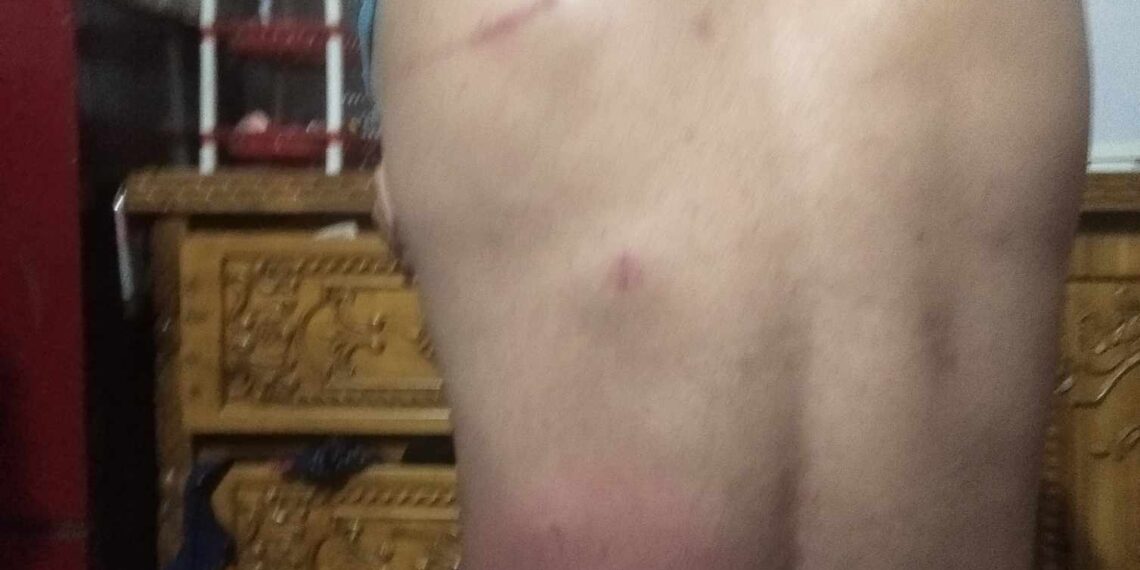 রূপগঞ্জে সৌদি প্রবাসীর বাড়িতে ডাকাতি, স্বর্ণালংকারসহ লক্ষাধিক টাকা লুট, আহত – ২: Nafiz Ashraf.Tnntv24