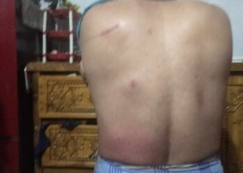 রূপগঞ্জে সৌদি প্রবাসীর বাড়িতে ডাকাতি, স্বর্ণালংকারসহ লক্ষাধিক টাকা লুট, আহত – ২: Nafiz Ashraf.Tnntv24