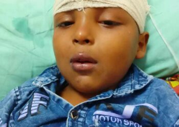 রূপগঞ্জে পাঁচ বছরের শিশু প্রতিপক্ষের ইটের আঘাতে গুরুতর অবস্থা।Nafiz Ashraf.Tnntv24