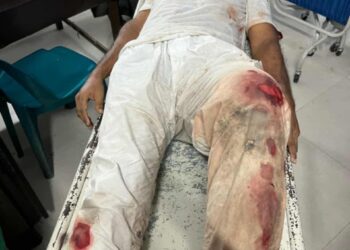 রূপগঞ্জে চাঁদার টাকা না পেয়ে বৃদ্ধকে গুলি করে হত্যার চেষ্টা : Nafiz Ashraf.Tnntv24