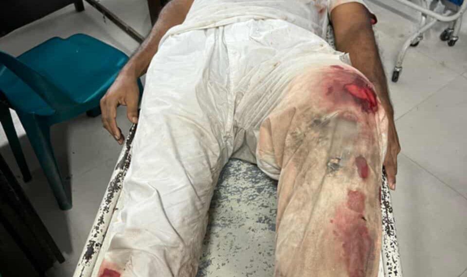 রূপগঞ্জে চাঁদার টাকা না পেয়ে বৃদ্ধকে গুলি করে হত্যার চেষ্টা : Nafiz Ashraf.Tnntv24