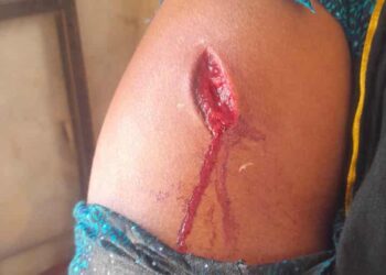 রূপগঞ্জে পূর্ব শত্রুতার জেরে হামলা ভাংচুর: Nafiz Ashraf.Tnntv24