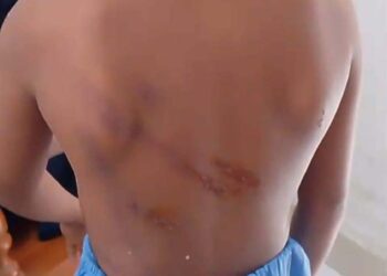 সোনারগাঁওয়ে মাদ্রাসা ছাত্রকে বেত্রাঘাতে নির্যাতনের অভিযোগ,থানায় অভিযোগ, শিক্ষকের বিরুদ্ধে। Nafiz Ashraf.Tnntv24