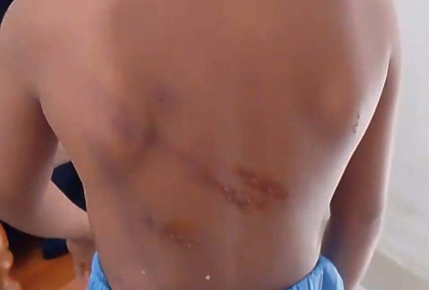 সোনারগাঁওয়ে মাদ্রাসা ছাত্রকে বেত্রাঘাতে নির্যাতনের অভিযোগ,থানায় অভিযোগ, শিক্ষকের বিরুদ্ধে। Nafiz Ashraf.Tnntv24