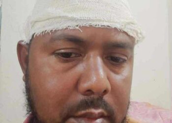 রূপগঞ্জে সন্ত্রাসী হামলায় নারী ও শিশুসহ   আহত ৩।। থানায় অভিযোগ :Nafiz Ashraf.Tnntv24