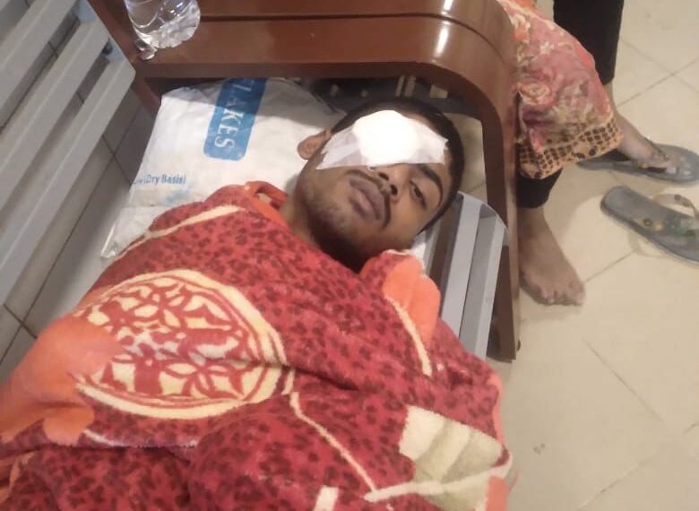 রূপগঞ্জে মুক্তিপণ না পেয়ে কলেজ শিক্ষার্থীকে চোখ উপড়ে হত্যার চেষ্টা:Nafiz Ashraf.Tnntv24