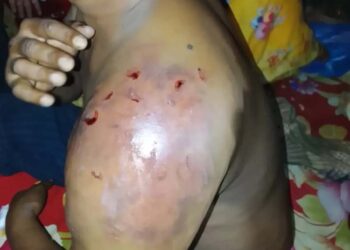 সোনারগাঁয়ে ব্যবসায়ী অপহরণের অভিযোগ হাতুড়াপেটার পর মুক্তিপনে মুক্তি:Nafiz Ashraf.Tnntv24