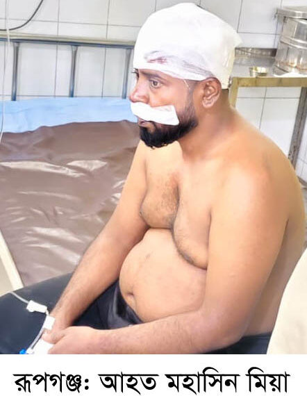 রূপগঞ্জে অবৈধ গরুর হাটের নিয়ন্ত্রণ কেন্দ্র করে  দুই গ্রুপের সংঘর্ষে আহত ৫: Nafiz Ashraf.Tnntv24