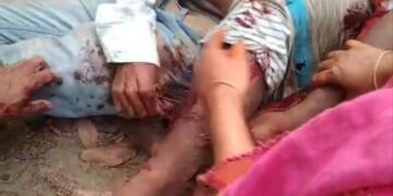 রূপগঞ্জে  ছেলের হামলায় বাবা ও বড়ভাই  টেটাবিদ্ধ// তিনটি দেশি অস্ত্র উদ্ধার: Tnntv24